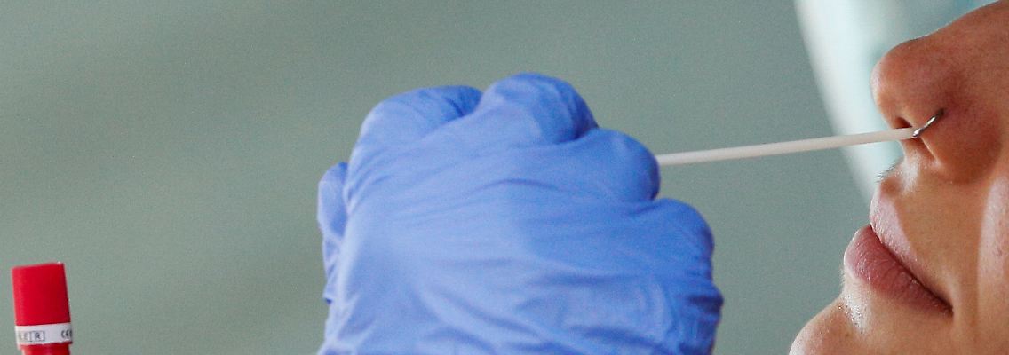 PCR Test.JPG