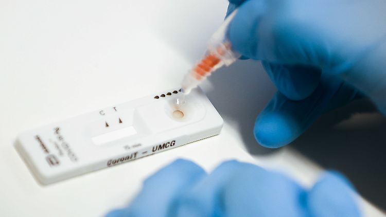 Jeder Schnelltest ersetzt einen aufwändigen PCR-Test. Das schafft neue Kapazitäten.
