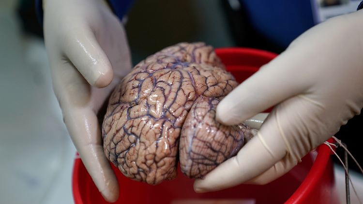Die Forscher analysierten die Ergebnisse von 84.285 Personen, die eine Studie namens Great British Intelligence Test abgeschlossen hatten.