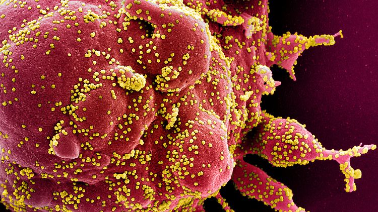In Spanien weisen laut Studie fast 80 Prozent der Proben die neue Coronavirus-Variante 20A.EU1 auf. In Großbritannien sind es sogar 90 Prozent.
