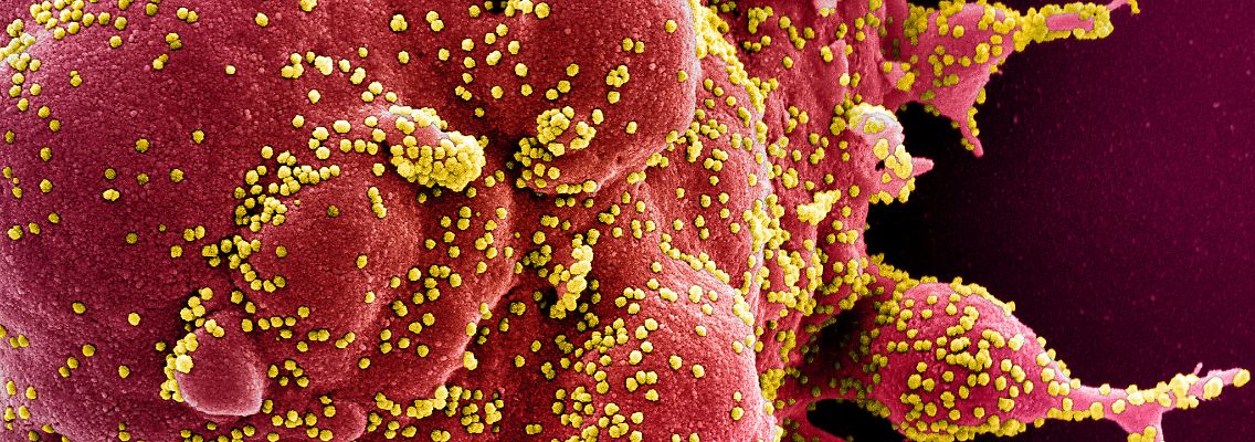 2020-10-14T230726Z_284795613_RC2NIJ93TO2L_RTRMADP_3_HEALTH-CORONAVIRUS-LONG-COVID.JPG