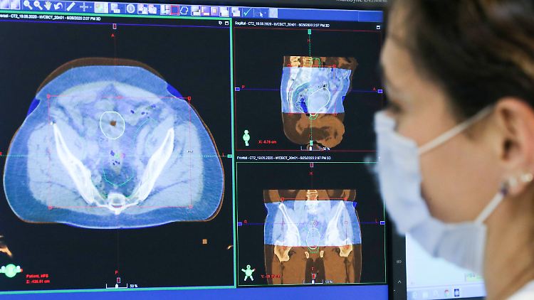 Der Zeitpunkt der Krebsdiagnose ist entscheidend für die Erfolgsaussichten der Behandlung.