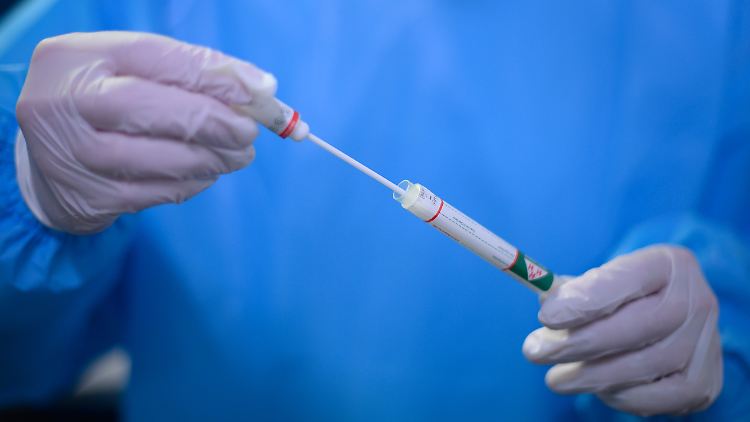 Das RKI zählt mittlerweile mehr als 700.000 nachgewiesene Corona-Infektionen in Deutschland.