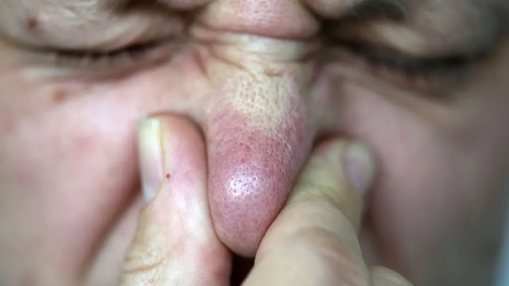 An-der-Uni-Jena-haben-Forschende-zusammen-mit-Wissenschaftler-der-TU-Dresden-eine-Geruchsdatenbank-aufgebaut-Mit-weiteren-Expertinnen-und-Experten-haben-sie-zudem-einen-Datensatz-erarbeitet-der-Koerpergerueche-erfasst