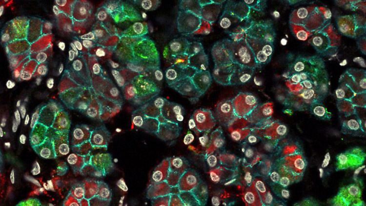 Immunfluoreszenzmikroskop-Aufnahme von Zellen in einer Speicheldrüse. Das Bild zeigt, dass die Zellen viel vielfältiger sind als bisher angenommen..