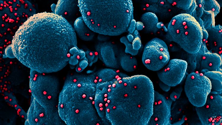 Das Medikament Molnupiravir soll die Übertragbarkeit von Sars-CoV-2 schnell reduzieren.