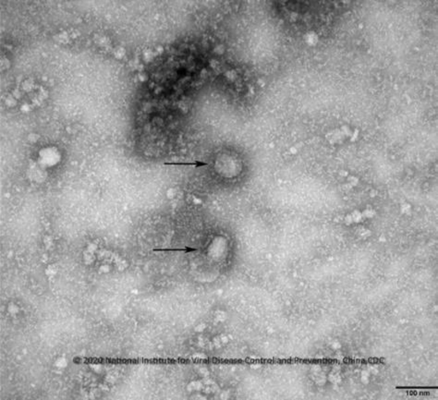 Selten wird ein Jahr so von einem Thema dominiert wie 2020. Das Coronavirus Sars-CoV-2, hier auf einer frühen Elektronenmikroskop-Aufnahme, ist täglich, sogar stündlich in den Nachrichten. Dabei gibt es dieses Jahr noch viele andere wichtige Entdeckungen und Errungenschaften in Forschung und Wissenschaft - hier eine Übersicht.