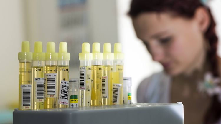 Im Urin lässt sich ab dem ersten Tag der Covid-19-Diagnose ablesen, wie schwer die Krankheit verlaufen wird.