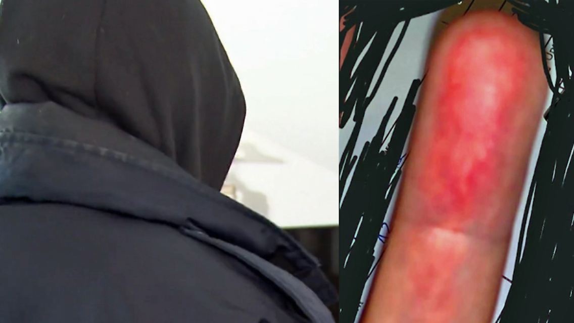 ber-finger6.jpg