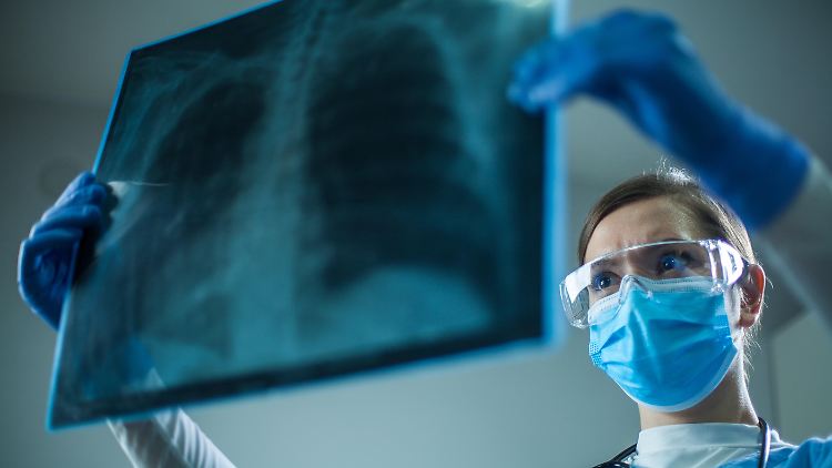Lungen- und Bronchialkrebs sind immer noch für die meisten Krebstoten verantwortlich.