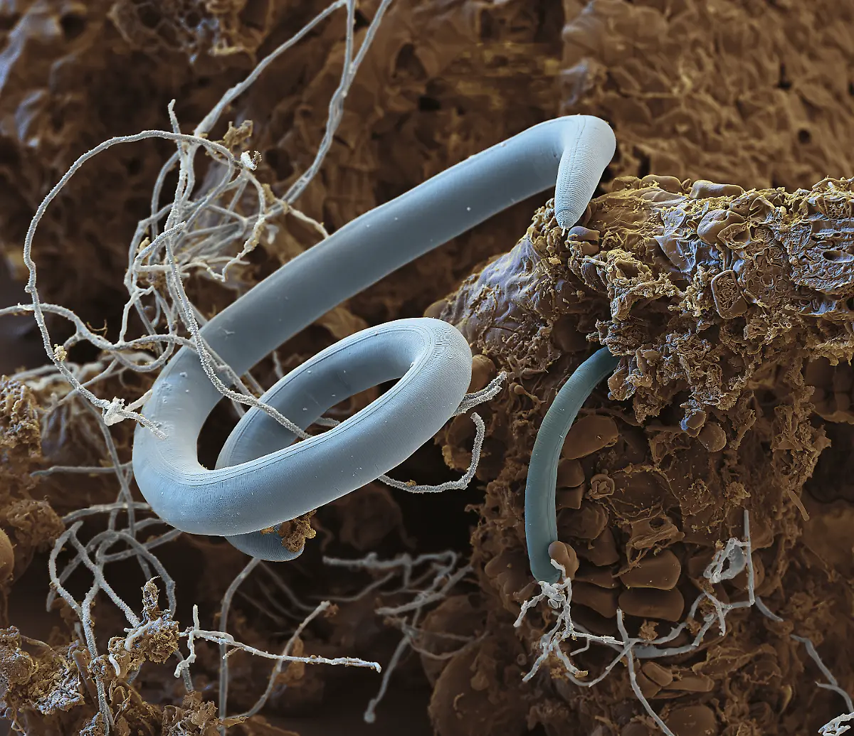 S126-Fadenwurm-400x-eye-of-science