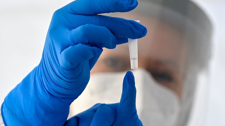 Antigen-Schnelltests liefern nach wenigen Minuten Ergebnisse.