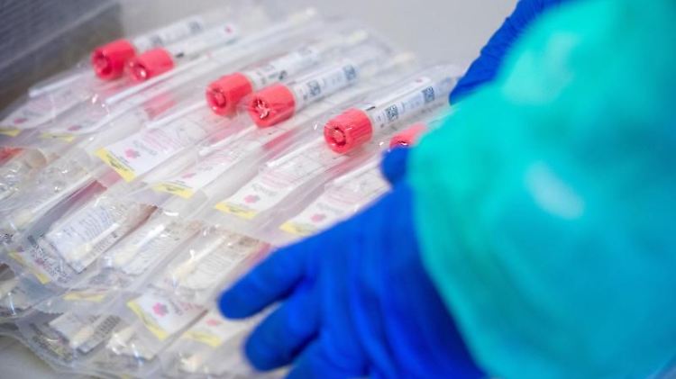 Testsets mit Abstrichstäbchen liegen in einem Testzentrum für Corona-Verdachtsfälle.