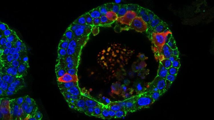 Lipocalin 2 (rot) ist ein Tränenbestandteil, der von den Organoiden, also von den Miniatur-Versionen menschlicher Tränendrüsen, gebildet wird.