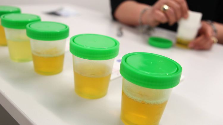 Mit Urinproben werden auch Doping-Tests durchgeführt. 