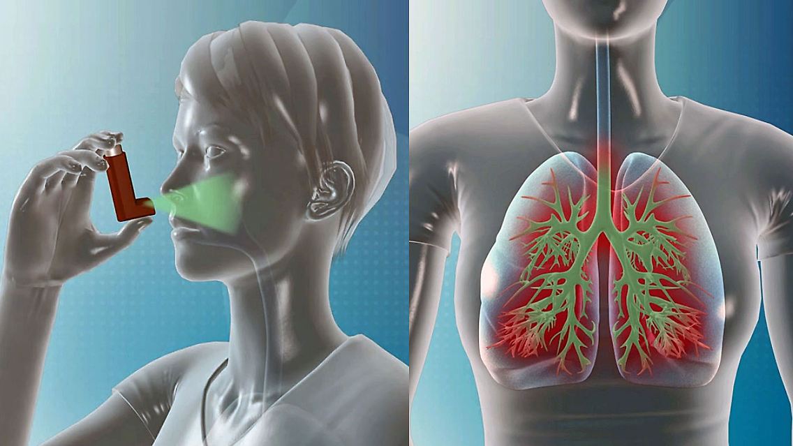 Asthmamittel.jpg