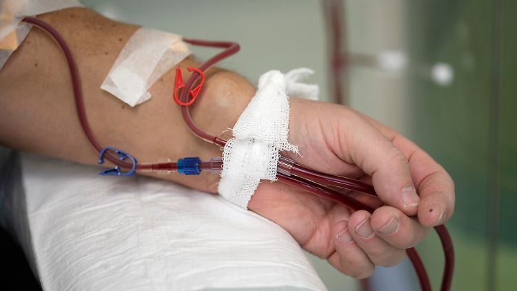 Mit dem Blutwäsche-Verfahren können Stoffe aus dem Blut entfernt werden, die zu übermäßigen Immunreaktionen führen.