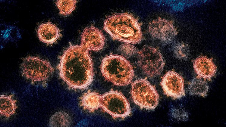 Das Virus Sars-CoV-2, wie es unter dem Elektronenmikroskop erscheint.