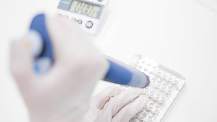 Laut RKI traten in der untersuchten Woche weniger als 30 Fälle von B.1.617 auf. Allerdings werden in Deutschland nur wenige Proben sequenziert.