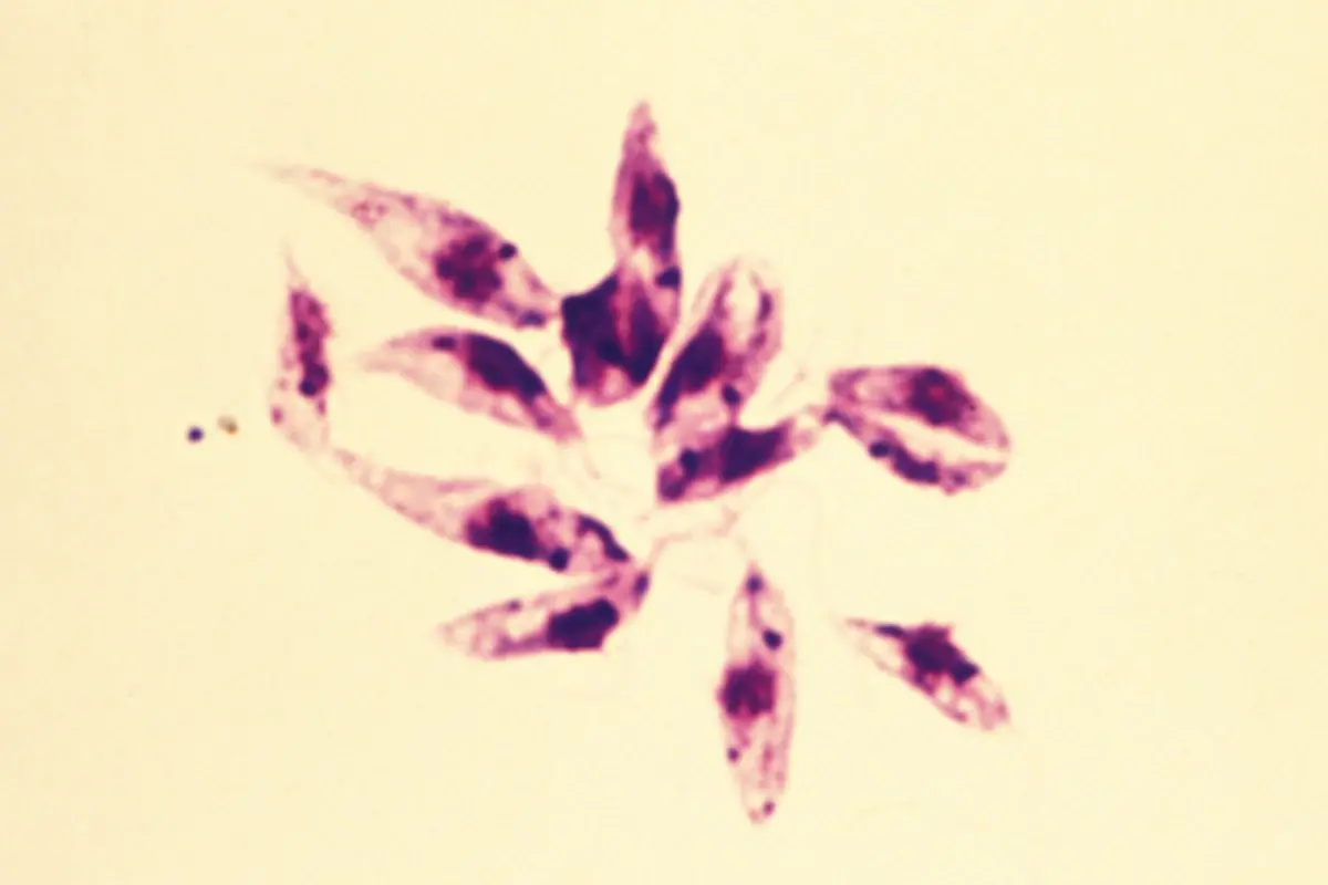 Leishmania-tropica-7