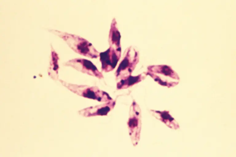 Leishmania-tropica-7