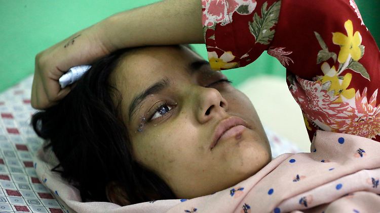 Ein verletztes afghanische Mädchen wird in einem Krankhaus in Kabul behandelt.