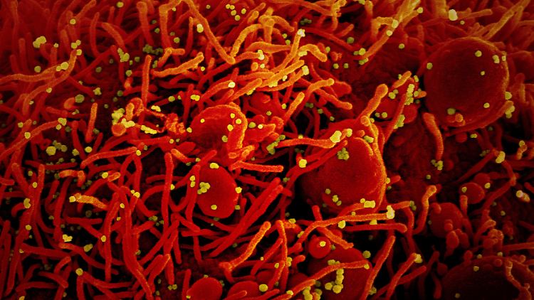 Die Aufnahme zeigt  eine Zelle (rot), die mit dem Coronavirus (SARS-CoV-2, gelb) infiziert ist. Sie wurde vom US-Forschungszentrum National Institute of Allergy and Infectious Diseases (NIAID) zur Verfügung gestellt.