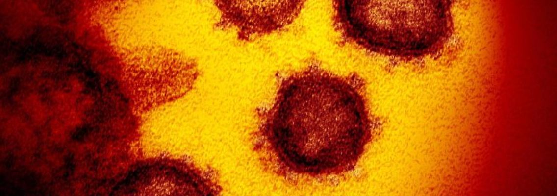 Eine elektronenmikroskopische Aufnahme zeigt das Coronavirus SARS-CoV-2. Foto: NIAID-RML/AP/dpa/Symbolbild