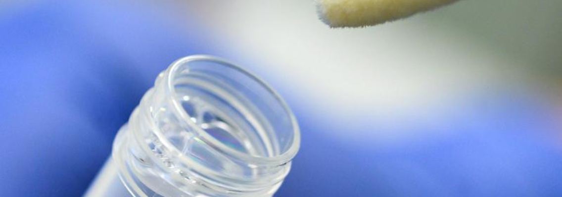 Ein Abstrich für das Testverfahren auf das Coronavirus. Foto: Sebastian Gollnow/dpa/Symbolbild