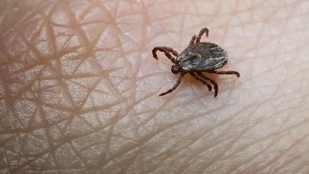 Grossaufnahme-einer-Zecke-auf-menschlicher-Haut-Die-Insekten-uebertragen-gefaehrliche-Krankheiten-und-sind-in-ganz-Deutschland-aktiv-auch-im-Winter