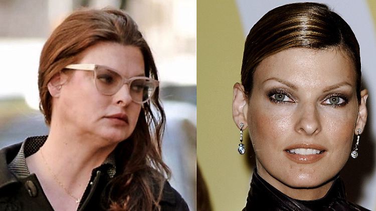 Bricht nach einem missglückten Beauty-Eingriff ihr Schweigen: Model Linda Evangelista.