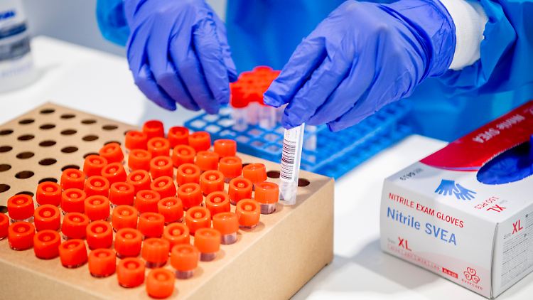 Das RKI meldet knapp 12.000 Neuinfektionen.
