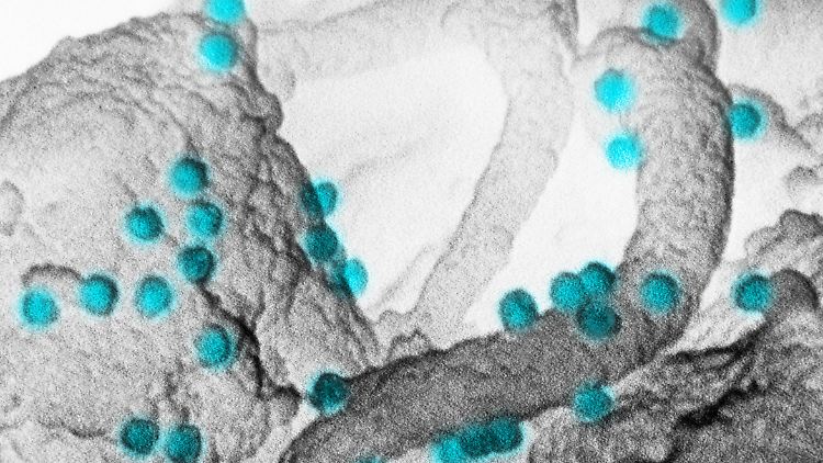 Gegen das HI-Virus gibt es bisher keinen wirksamen Impfstoff. Medikamente machen jedoch ein Leben mit dem Erreger möglich.