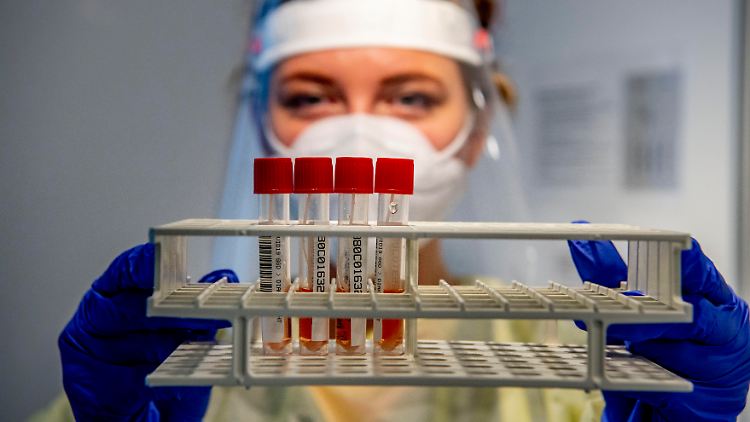 Das RKI zählte seit Beginn der Pandemie 4.342.640 nachgewiesene Infektionen mit Sars-CoV-2.