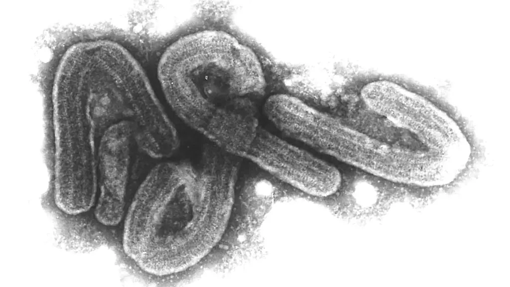 Elektronenmikroskopische-Aufnahme-des-Marburg-Virus-Das-Marburg-Virus-gehoert-zu-den-gefaehrlichsten-bekannten-Krankheitserregern