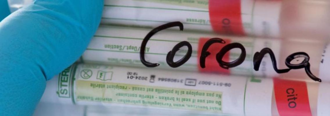 Proben für Corona-Tests werden für die weitere Untersuchung vorbereitet. Foto: Hendrik Schmidt/dpa-Zentralbild/Symbolbild