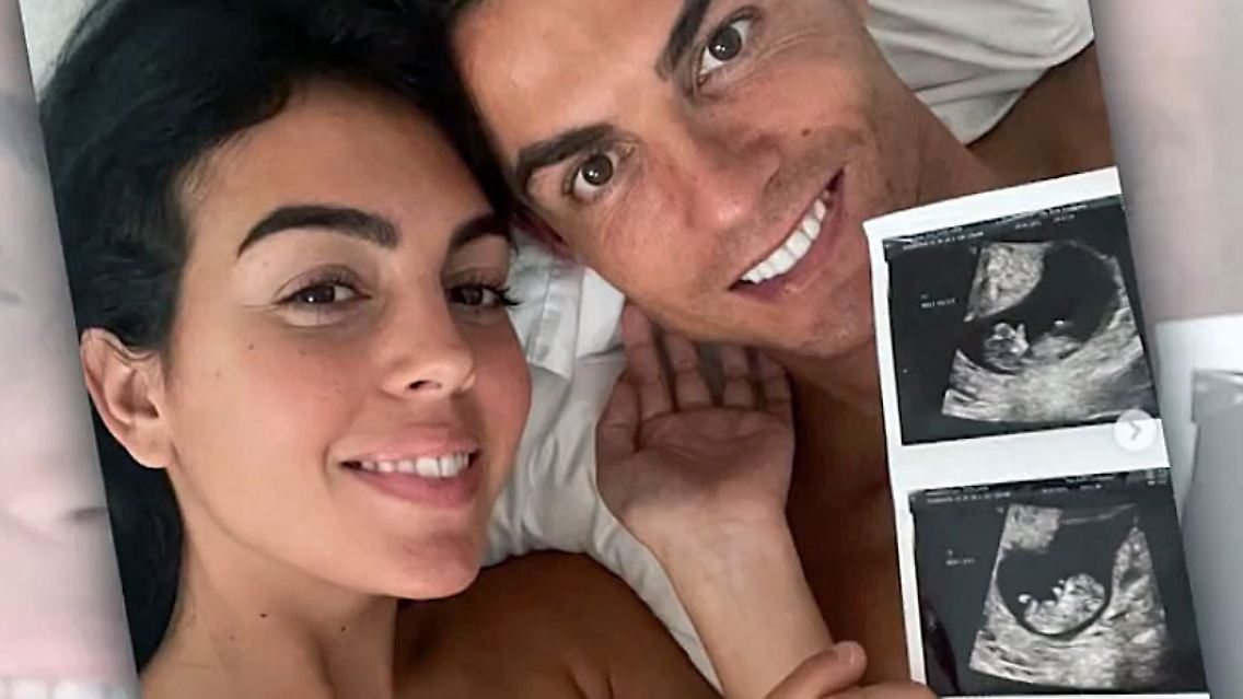 RonaldoZwillinge.jpg