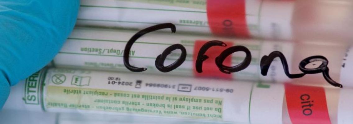 Proben für Corona-Tests werden für die weitere Untersuchung vorbereitet. Foto: Hendrik Schmidt/dpa-Zentralbild/Symbolbild