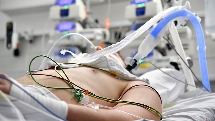 Die Anzahl der Intensivbetten für schwere Beatmungsfälle ist laut DIVI im Vergleich zum Vorjahr um ein Viertel gesunken.