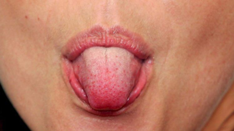 Im Speichel gibt es zahlreiche Enzyme. 