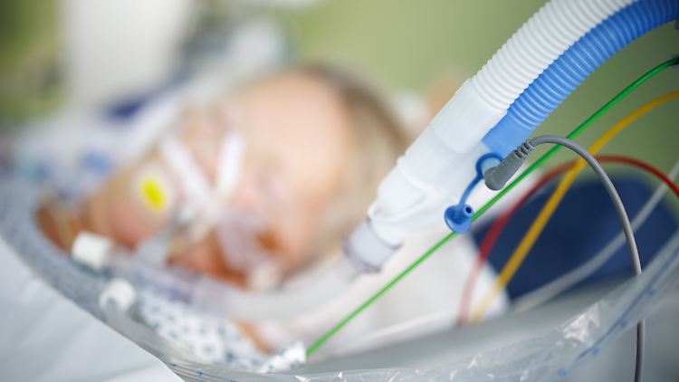 Bereits jetzt müssen Intensiv-Patienten in einigen Regionen verlegt werden. Viele Kliniken verschieben planbare OPs.