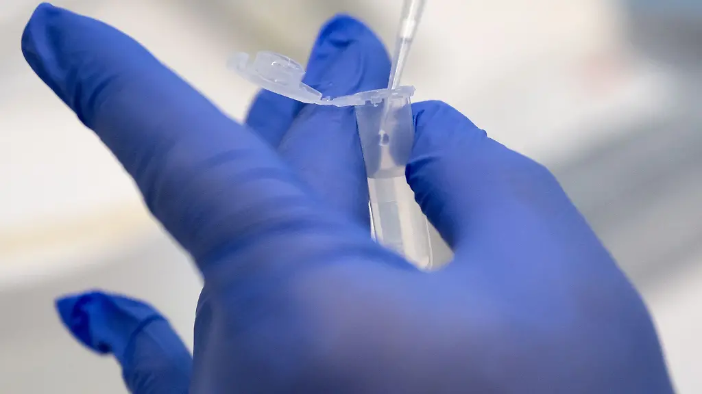 Die-Erforschung-hochansteckender-Viren-ist-das-Ziel-von-Forschern-an-der-Marburger-Philipps-Universitaet