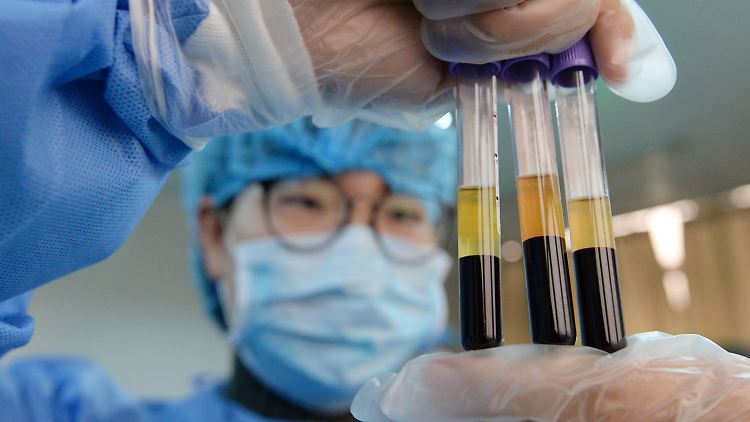 Ein Impfstoff gegen Aids lässt weiter auf sich warten.