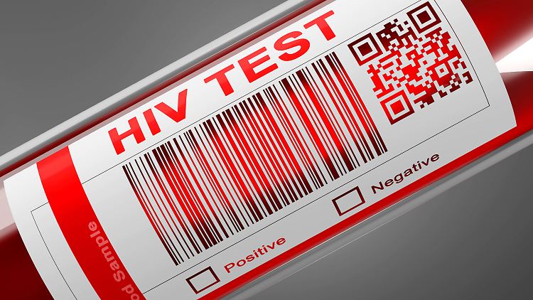 Es muss mehr HIV-Tests geben, fordern Experten. 