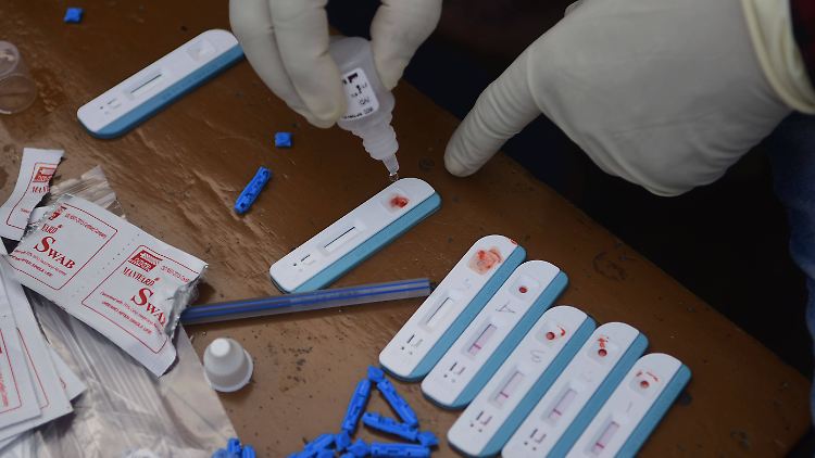 Beim Test auf das HI-Virus wird das Blut untersucht.