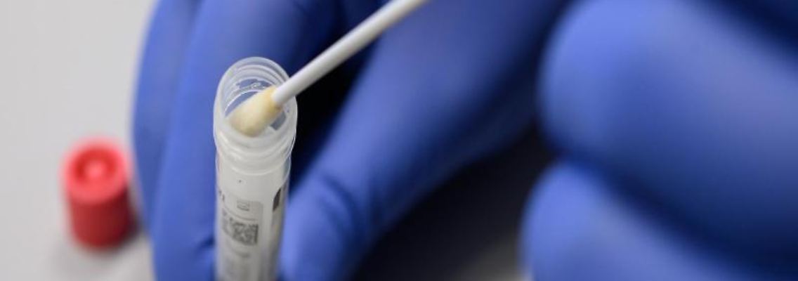 Ein Mann zeigt einen Abstrich für das Testverfahren auf das Virus Sars-CoV-2. Foto: Sebastian Gollnow/dpa/Symbolbild