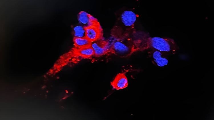 Von Omikron befallene Zellen (rot fluoreszierend).