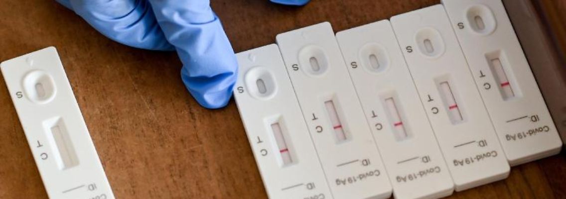 Testergebnisse von Corona-Schnelltests. Foto: Jens Kalaene/dpa-Zentralbild/Symbolbild