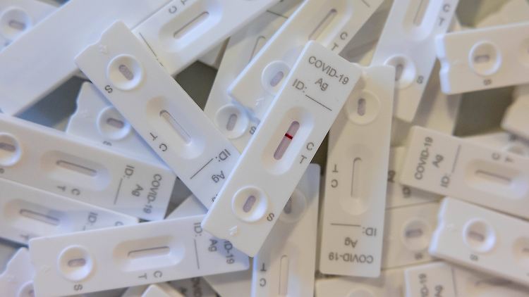 Antigen-Tests schlagen erst bei einer höheren Virusmenge an als PCR-Tests. Bei Omikron könnte sich die Sensitivität noch verschlechtern.