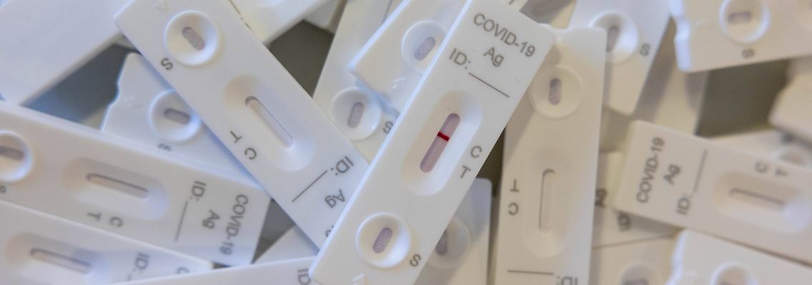 Antigen-Tests schlagen erst bei einer höheren Virusmenge an als PCR-Tests. Bei Omikron könnte sich die Sensitivität noch verschlechtern.
